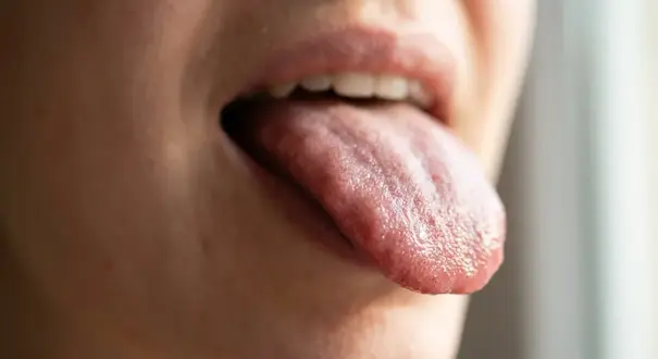 Close-up view of a healthy human tongue showing texture and taste buds